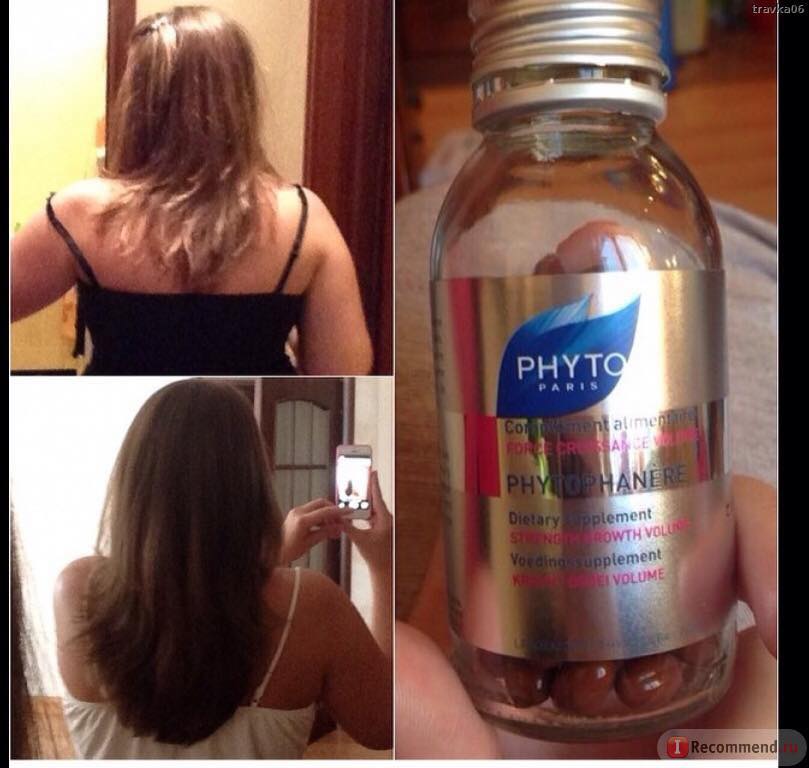 Thuốc mọc tóc Phyto Pháp có tốt không?