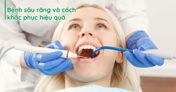 Bệnh sâu răng và cách khắc phục hiệu quả