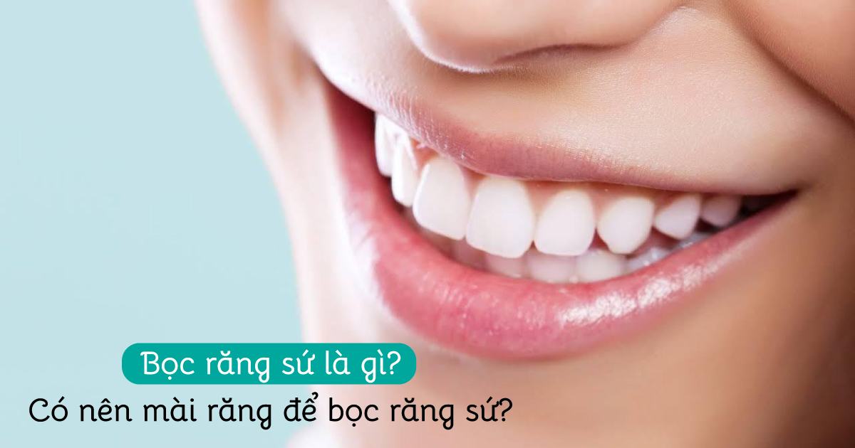 Bọc răng sứ là gì? Có nên mài răng để bọc răng sứ?
