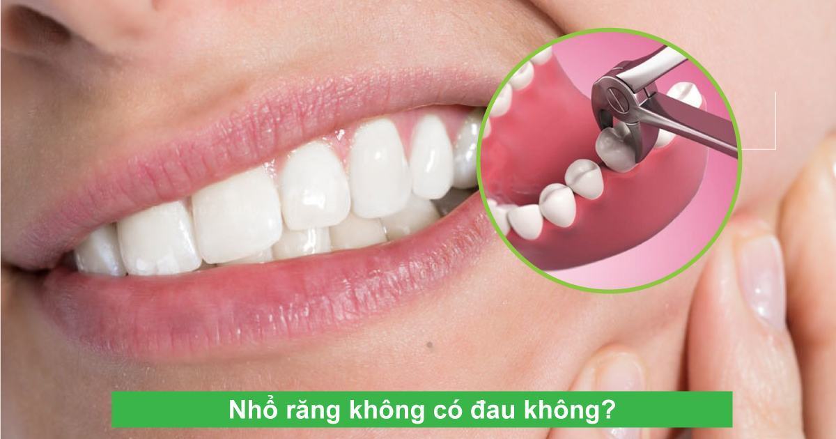 Khi nào cần nhổ răng khôn? Nhổ răng không có đau không?