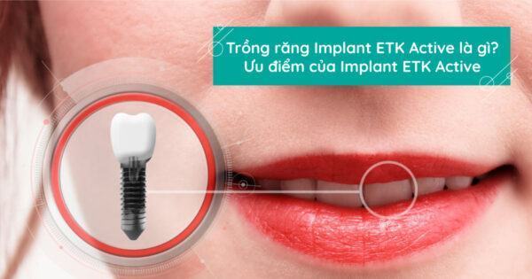 Trồng răng Implant ETK Active là gì? Ưu điểm của Implant ETK Active