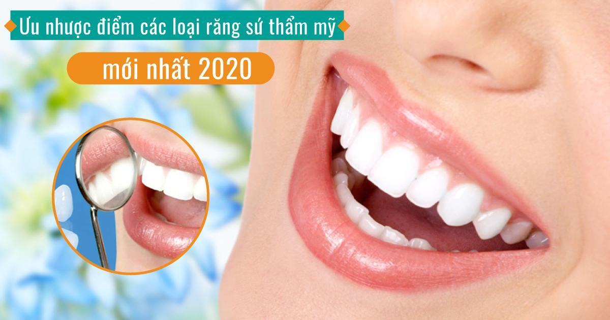 Ưu nhược điểm các loại răng sứ thẩm mỹ mới nhất 2020