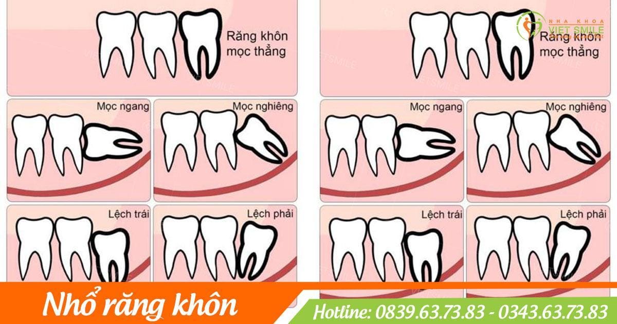 nho rang 8