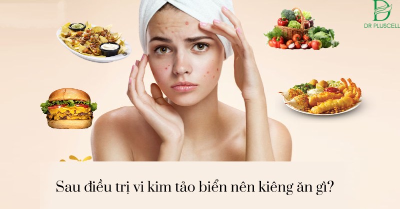 Nên kiêng ăn gì sau khi vi kim tảo? Bao lâu làm 1 lần?