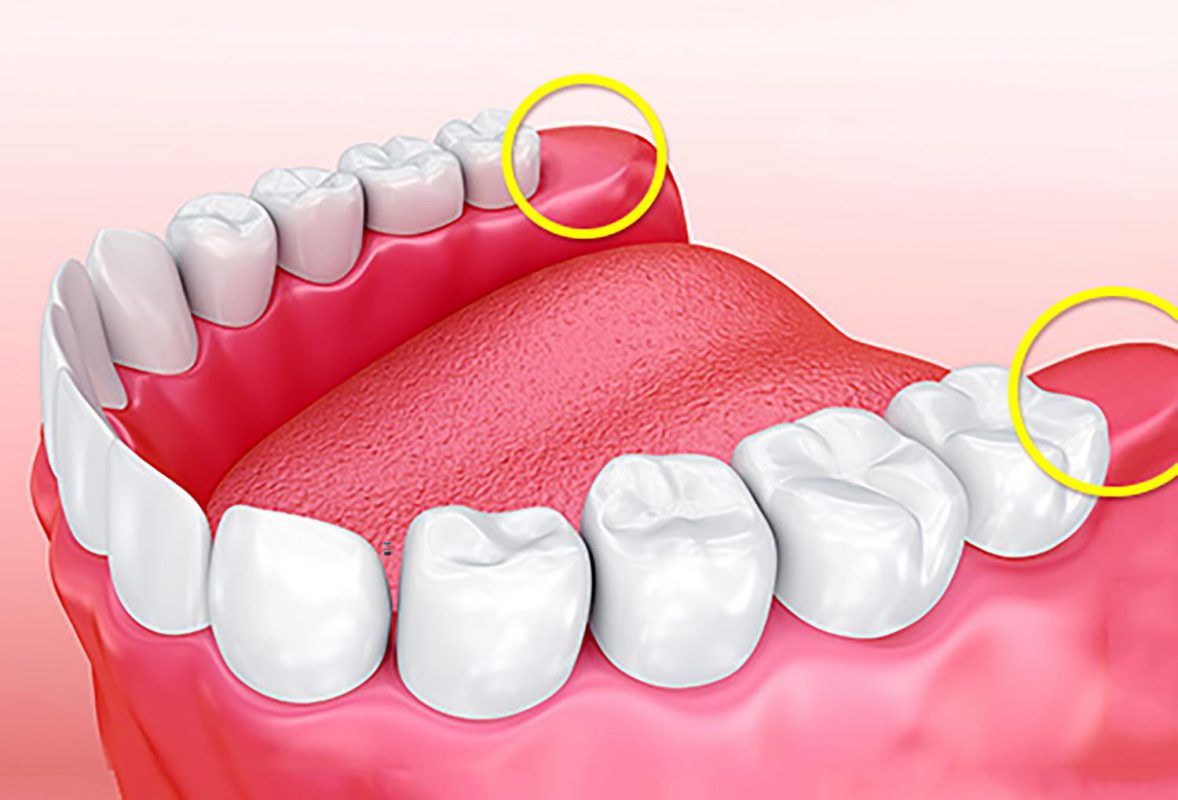 Răng khôn có tác dụng gì?